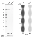 Western blot analysis in human cell lines A-549 and HEK293 using Anti-BCL9L antibody. Corresponding BCL9L RNA-seq data are presented for the same cell lines. Loading control: Anti-HDAC1.