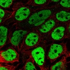Immunofluorescent staining of human cell line CACO-2 shows localization to nucleoplasm.