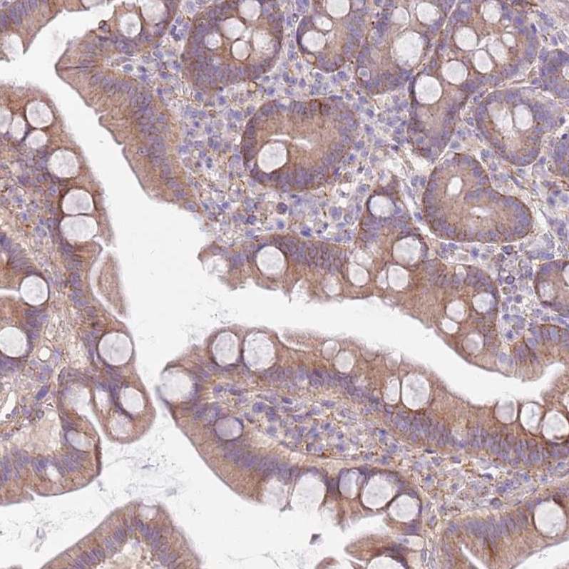 Anti-SNX6 Antibody