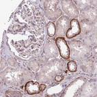 Immunohistochemical staining of human kidney shows strong membranous positivity in cells in tubules.