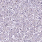 Immunohistochemical staining of human pancreas shows negative cytoplasmic positivity in exocrine glandular cells as expected.