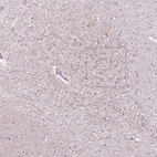 Anti-CNGA3 Antibody