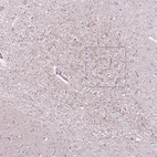 Anti-CNGA3 Antibody
