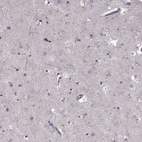 Immunohistochemical staining of human cerebral cortex shows moderate membranous positivity in neuropil.