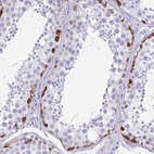 Anti-TSPY4 Antibody