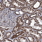 Immunohistochemical staining of human kidney shows strong granular cytoplasmic positivity in cells in tubules.