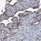 Immunohistochemical staining of human placenta shows strong granular cytoplasmic positivity in trophoblastic cells.