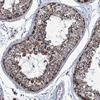 Immunohistochemical staining of human testis shows strong granular cytoplasmic positivity in cells in seminiferous ducts.