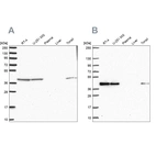 Western blot analysis using Anti-IDH3B antibody HPA049387 (A) shows similar pattern to independent antibody HPA054180 (B).