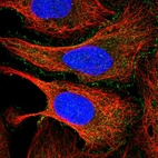 Immunofluorescent staining of human cell line U-2 OS shows localization to plasma membrane.