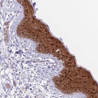 Anti-FBXO46 Antibody