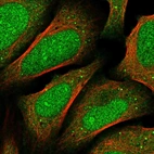 Immunofluorescent staining of human cell line U-2 OS shows localization to nucleus, cytosol & vesicles.