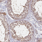 Anti-HYAL3 Antibody