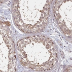 Anti-HYAL3 Antibody