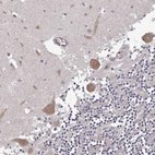 Immunohistochemical staining of human cerebellum shows moderate cytoplasmic positivity in Purkinje cells.