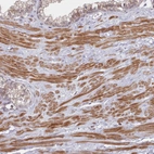 Immunohistochemical staining of human prostate shows moderate cytoplasmic positivity in smooth muscle cells and additionally weak membranous positivity in glandular cells,