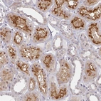 Immunohistochemical staining of human kidney shows strong membranous-cytoplasmic positivity in cells in tubules.