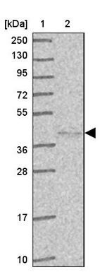 Lane 1: Marker [kDa] 250, 130, 95, 72, 55, 36, 28, 17, 10_br/_Lane 2: Human cell line RT-4