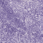 Immunohistochemical staining of human tonsil shows no positivity in non-germinal center cells as expected.