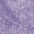 Immunohistochemical staining of human tonsil shows no positivity in non-germinal center cells as expected.