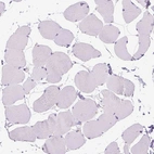 Immunohistochemical staining of human skeletal muscle shows no positivity in myocytes as expected.