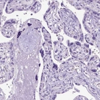 Immunohistochemical staining of human placenta shows no positivity in trophoblastic cells as expected.