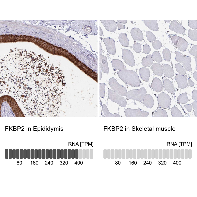 Anti-FKBP2 Antibody