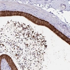 Immunohistochemical staining of human epididymis shows high expression.