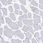 Immunohistochemical staining of human skeletal muscle shows low expression as expected.
