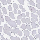 Immunohistochemical staining of human skeletal muscle shows low expression as expected.