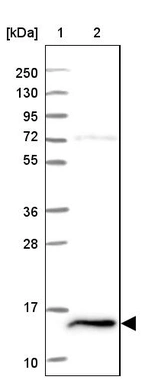 Lane 1: Marker [kDa] 250, 130, 95, 72, 55, 36, 28, 17, 10_br/_Lane 2: Human cell line RT-4