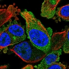 Immunofluorescent staining of human cell line PC-3 shows localization to plasma membrane.