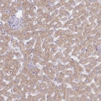 Immunohistochemical staining of human liver shows moderate positivity in endoplasmic reticulum in hepatocytes.