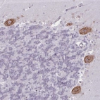Immunohistochemical staining of human cerebellum shows moderate to strong positivity in endoplasmic reticulum in Purkinje cells.