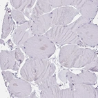 Immunohistochemical staining of human skeletal muscle shows no positivity in myocytes as expected.