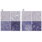 Anti-UHRF1 Antibody