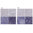 Anti-UHRF1 Antibody