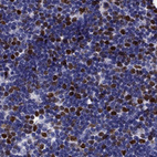 Anti-UHRF1 Antibody