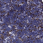 Immunohistochemical staining of human thymus using Anti-UHRF1 antibody HPA049408.