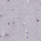 Immunohistochemical staining of human cerebral cortex using Anti-UHRF1 antibody HPA049408.