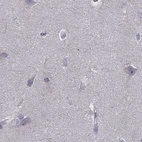 Immunohistochemical staining of human cerebral cortex using Anti-UHRF1 antibody HPA049408.