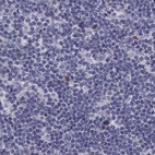 Immunohistochemical staining of human lymph node using Anti-UHRF1 antibody HPA049408.