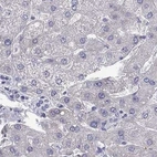 Immunohistochemical staining of human liver using Anti-UHRF1 antibody HPA049408.