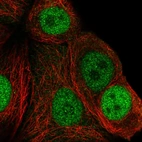 Immunofluorescent staining of human cell line MCF7 shows localization to nucleoplasm.