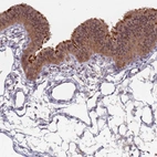 Immunohistochemical staining of human fallopian tube shows moderate cytoplasmic positivity in glandular cells.