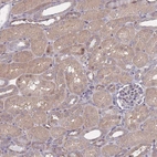 Immunohistochemical staining of human kidney shows moderate cytoplasmic positivity in cells in tubules.