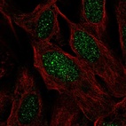 Immunofluorescent staining of human cell line U-2 OS shows localization to nucleus.