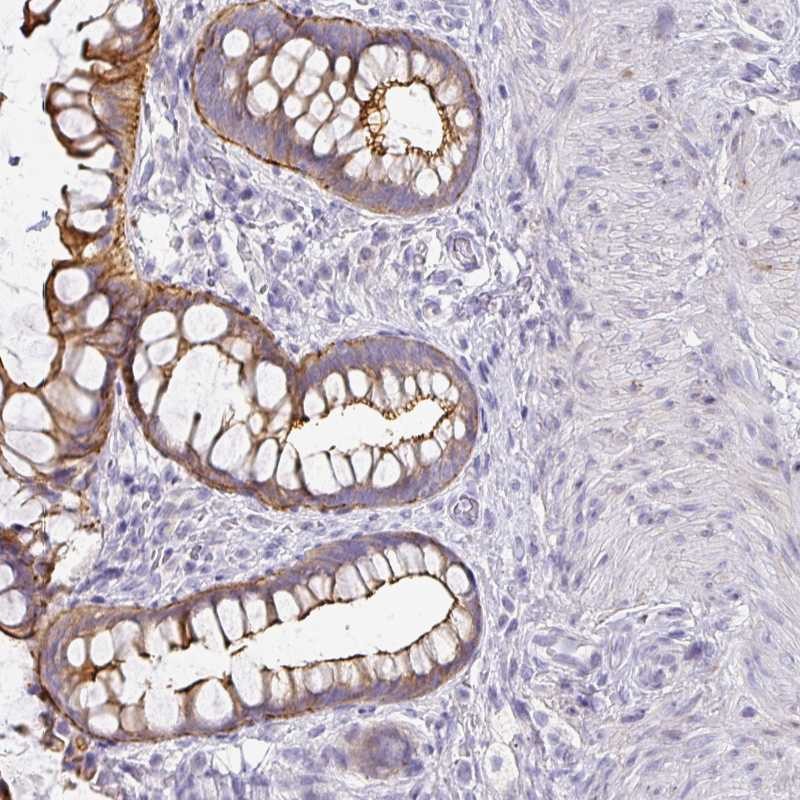 Anti-ANKRD29 Antibody