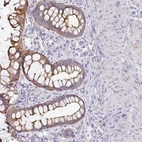 Anti-ANKRD29 Antibody