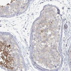 Immunohistochemical staining of human testis shows weak to moderate membranous positivity in cells in seminiferous ducts.